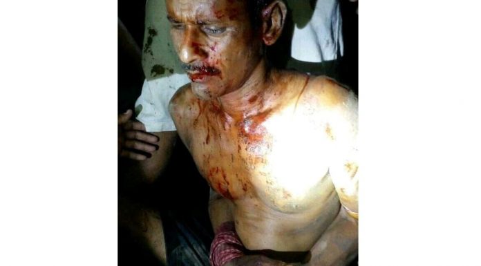 महोत्तरीमा भीषण डकैती: डाका र गाउँलेबीच भिडन्त, एक डाका पक्राउ ।