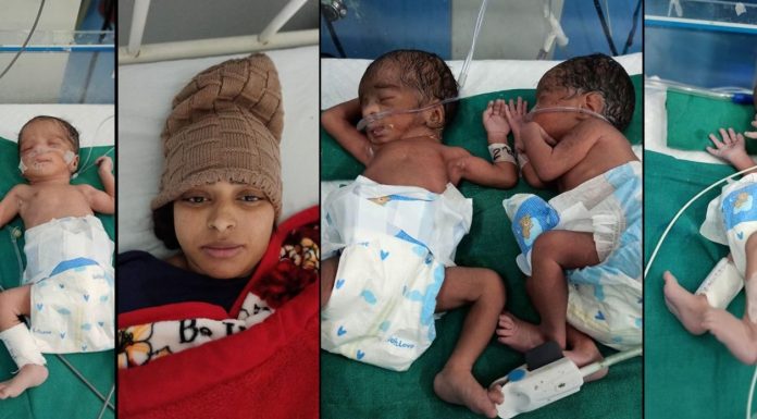 मणिपाल हस्पिटलमा २६ वर्षीकी महिलाले एकै पटक जन्माइन् ३ छोरी र १ छोरा ।