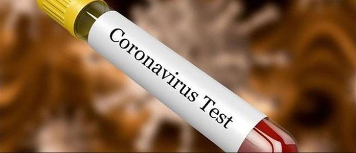 संक्रमितको सम्पर्कमा आएका ४६ जनाको स्वाब संकलन रौतहटमा ।