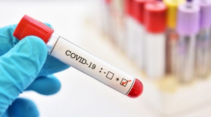 नेपालमा कोरोना संक्रमितको संख्या १ सय ३४ पुगेको ।