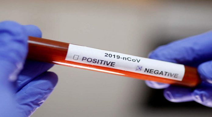 कोरोना परीक्षण, रिपोर्ट निगेटिभ रौतहटकमा ९१ जनाको ।